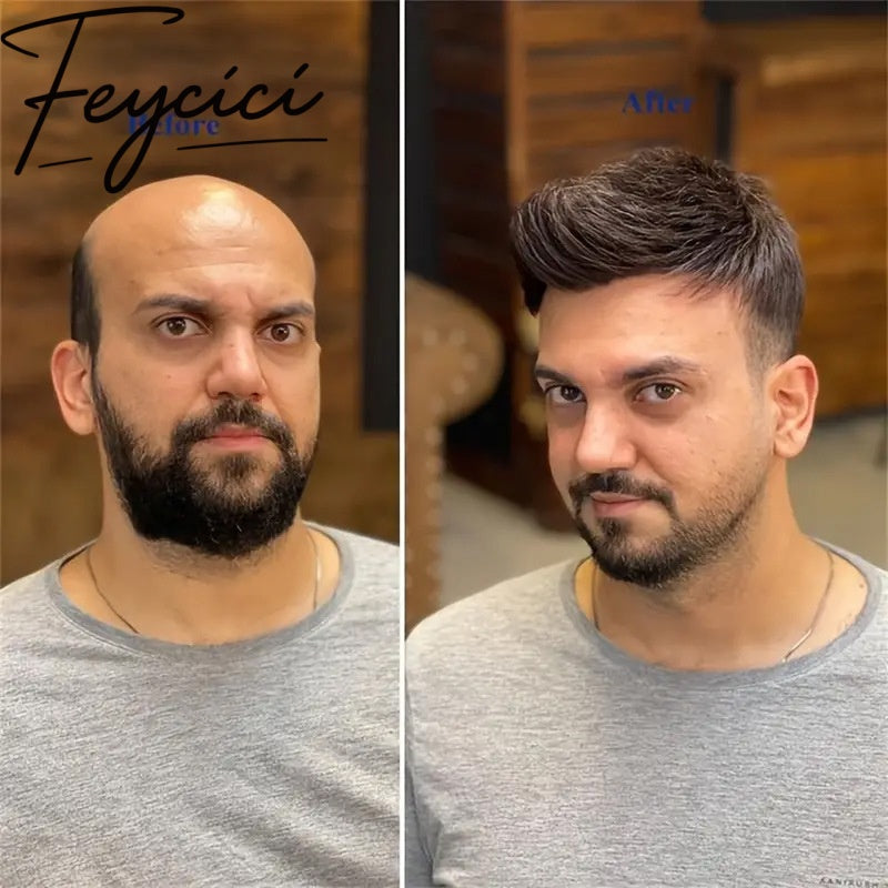 French Lace Top With Pu Mens Wigs Baldness-Natural Hair Piece-Free Style Hair System
