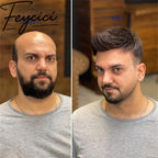 French Lace Top With Pu Mens Wigs Baldness-Natural Hair Piece-Free Style Hair System