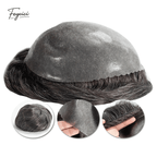 Second Skin Series - Seamless Injected Bio-Skin Men's Human Hair Toupee